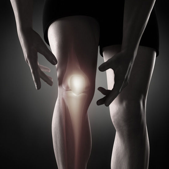 knee arthrtitis 1