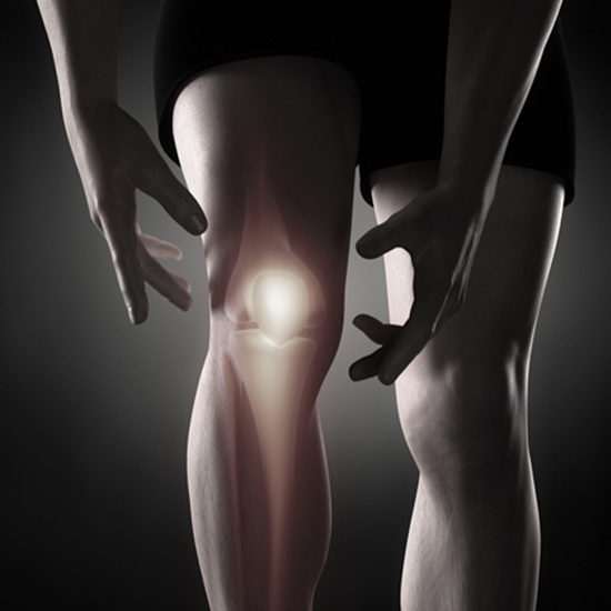 knee arthrtitis 1